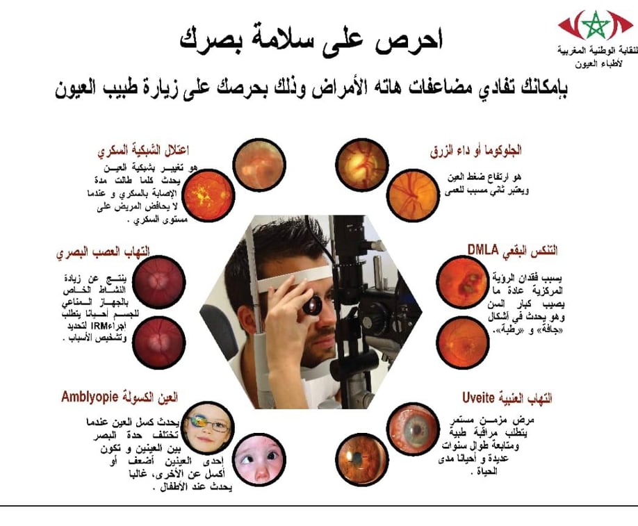 النقابة الوطينة لأطباء العيون تطالب رئيس الحكومة ووزير الصحة بالتدخل لحماية صحة المواطنين