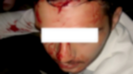 الشرطة الإسبانية تعتقل نجل ملياردير مغربي بسبب الضرب والجرح داخل ملهى ليلي بماربيا