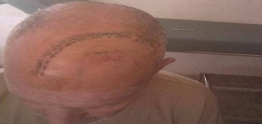 سرطان المخ ينهش رأس مريض في تمسمان ودعوات للتبرع من أجل  إنقاذ حياته