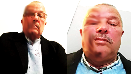 والد تلميذ يتسبب في جرح غائر لمدير مدرسة ابتدائية ببني انصار  والد تلميذ يتسبب في جرح غائر لمدير مدرسة ابتدائية ببني انصار