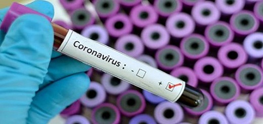 بلد عربي جديد يعلن تسجيل  أول حالة مؤكدة للإصابة بفيروس "كورونا"