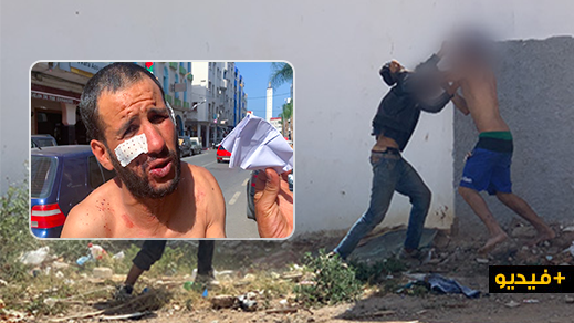 شاهدوا.. حارس السيارات ضحية الاعتداء من طرف "حراكة" بالناظور يروي تفاصيل الواقعة شاهدوا.. حارس السيارات ضحية الاعتداء من طرف "حراكة" بالناظور يروي تفاصيل الواقعة