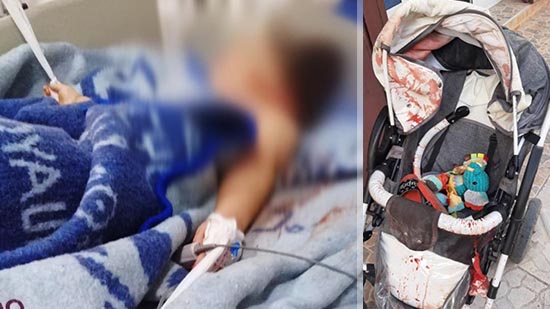 في مشهد مؤلم ولا إنساني.. ربط طفلة ضحية حادثة سير مع السرير داخل المستشفى الحسني بالناظور
