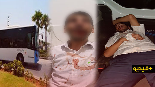 اعتداء شنيع على سائق حافلة  “فيكتاليا” بالضرب والجرح من طرف ثلاثة ركاب   