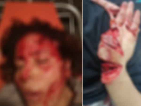 صادم.. شخص "يشرمل" زوجته لتصويرها فيديوهات "روتيني اليومي" صادم.. شخص "يشرمل" زوجته لتصويرها فيديوهات "روتيني اليومي"