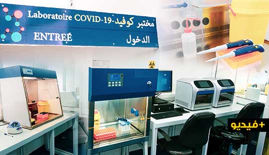 تجهيز مختبر كوفيد 19 بالحي الإداري بجميع التجهيزات وهذه كلفة التحاليل 