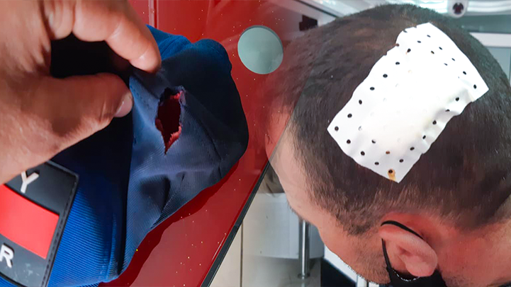 عصابة ملثمة بالناظور تعرض عون سلطة لاعتداء جسدي يخلف له جرحا غائرا في الرأس