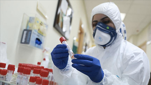 تسجيل 305 حالة إصابة بفيروس كورونا المستجد بالمغرب