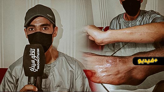 رب أسرة بحي بوبلاو يعاني بعد الاعتداء عليه ويناشد السلطات القبض على الجناة