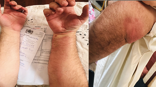 الناموس بالناظور يرسل مواطنا إلى المستعجلات 