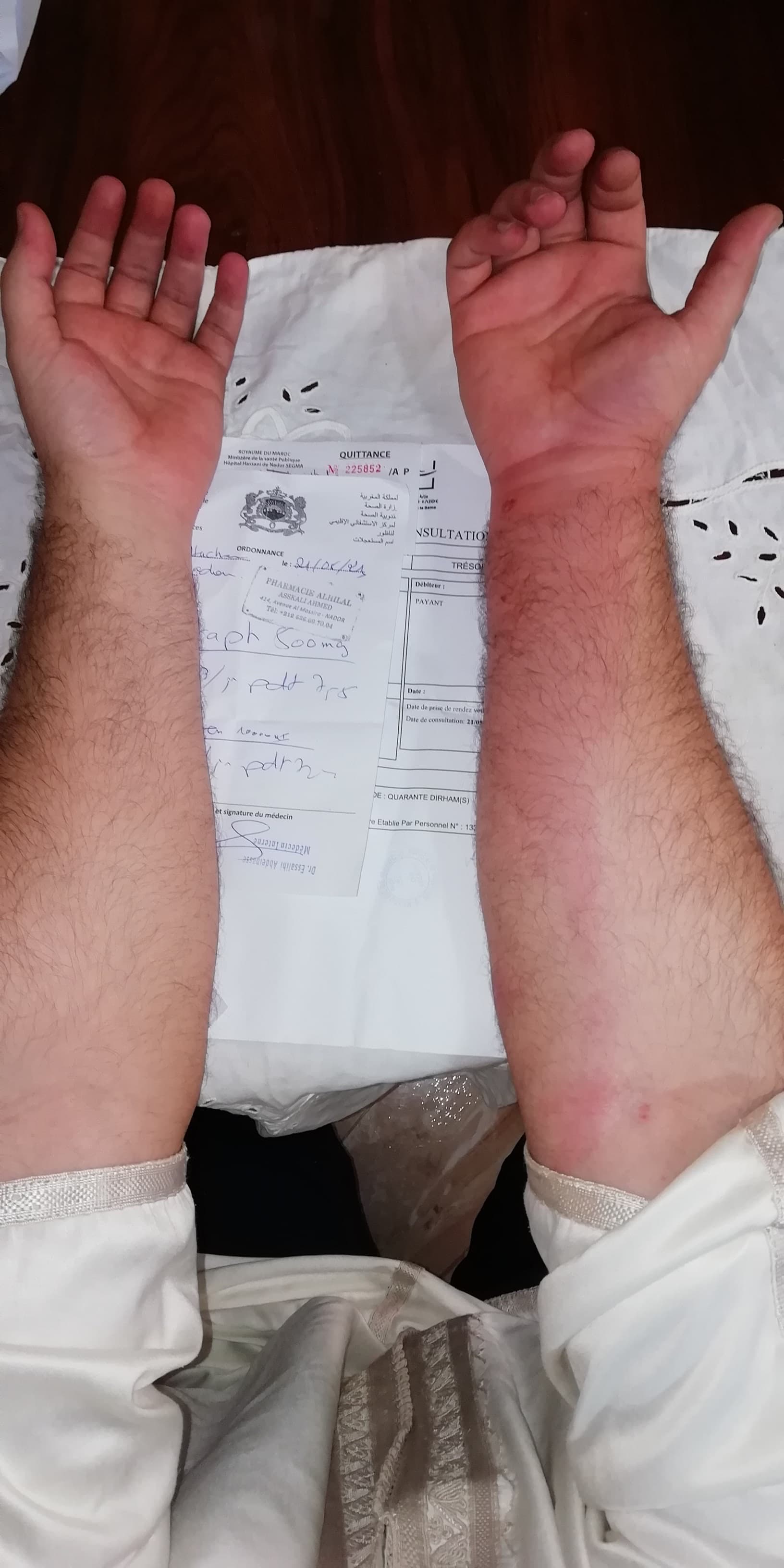 الناموس بالناظور يرسل مواطنا إلى المستعجلات 