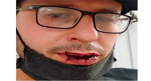 معتقل حراك الريف السابق ربيع الأبقل يخيط فمه تضامنا مع الصحفي الريسوني ويطالب بإطلاق سراحه معتقل حراك الريف السابق ربيع الأبقل يخيط فمه تضامنا مع الصحفي الريسوني ويطالب بإطلاق سراحه