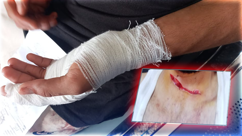 لصان يسرقان شابا  في "ترقاع" ويرسلونه إلى المستشفى في حالة حرجة 