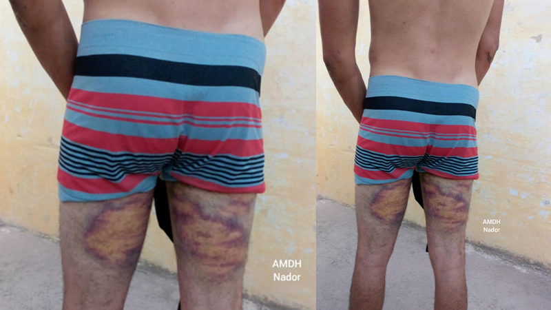 شابين بالناظور يتهمان عنصرين من حرس الحدود بمحاولة إغتصابهما