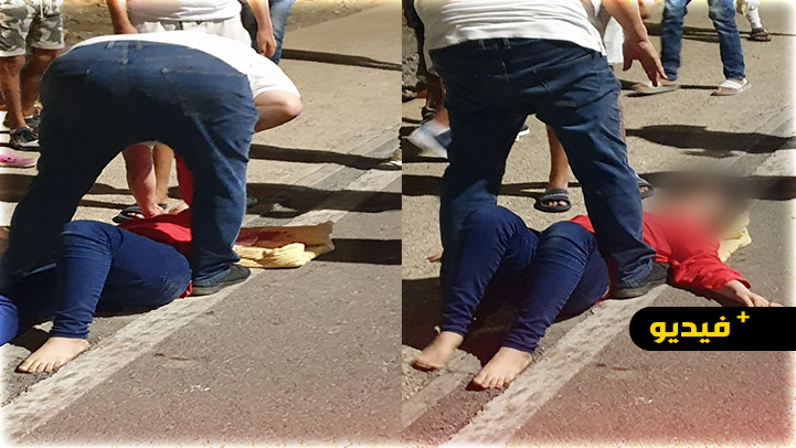 حادثة سير خطيرة ترسل شابة بين الحياة والموت للمستشفى الإقليمي بالناظور