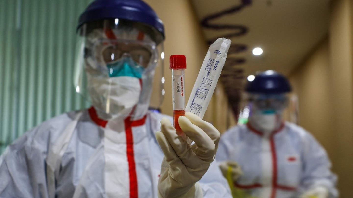 منظمة الصحة: سينتهي فيروس كورونا عندما يختار العالم القضاء عليه   منظمة الصحة: سينتهي فيروس كورونا عندما يختار العالم القضاء عليه