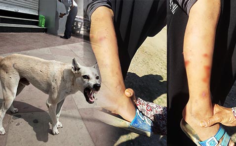 مسنة تنقذ طفل من عضة كلب هائج وسط الناظور