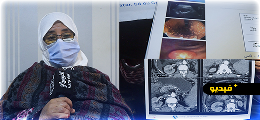 سيدة تعاني أمراضا مزمنة تناشد المحسنين لمساعدتها