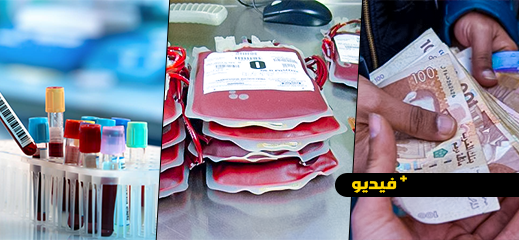 عبد الواحد قنديل يوضح: الدم المقدم للمرضى لا يباع