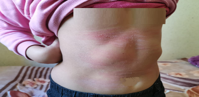 تعنيف تلميذة بالناظور يثير سخطا بمواقع التواصل الاجتماعي والمديرية الإقليمية تستمع للضحية