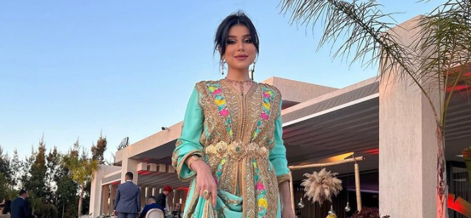 ابنة الناظور حنان الخضر تمثل المغرب في مسابقة أجمل وجه في العالم