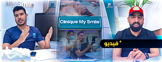 مركز "ابتسامتي" للدكتور ادريس بنسارية يصحح ابتسامة الكوميدي بوزيان 