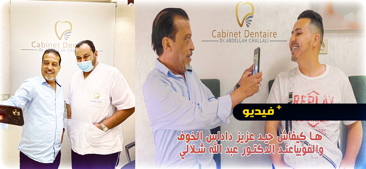 ها كيفاش حيد الممثل المغربي عزيز داداس الخوف والفوبيا في عيادة الدكتور عبد الله شلالي بالناظور ها كيفاش حيد الممثل المغربي عزيز داداس الخوف والفوبيا في عيادة الدكتور عبد الله شلالي بالناظور