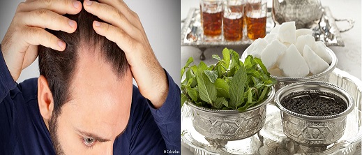 دراسة: الشاي والمشروبات المحلاة تسبب الصلع