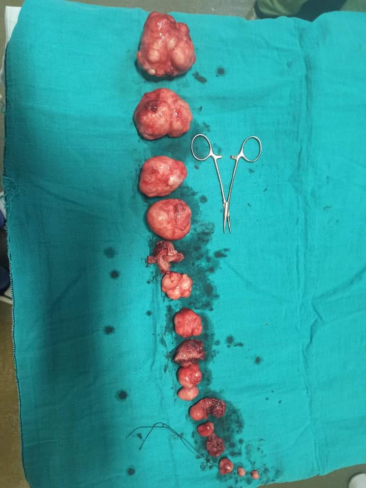 الدكتور بوتخريط ينجح في إزالة أورام حميدة بدون المساس برحم شابة مريضة الدكتور بوتخريط ينجح في إزالة أورام حميدة بدون المساس برحم شابة مريضة