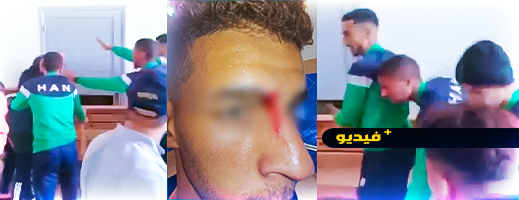 شاهدوا.. محسوبون على جماهير نهضة زايو يعتدون على لاعبي وطاقم الهلال وصحفيين بأكليم