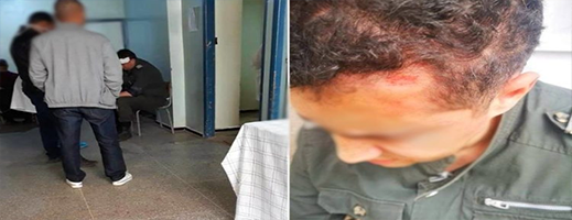 تهشيم رأس قائد على يد "سودور" يجر الأخير للإعتقال تهشيم رأس قائد على يد "سودور" يجر الأخير للإعتقال