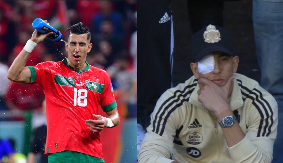 الياميق يكشف نتائج الفحوصات الطبية على عينه الياميق يكشف نتائج الفحوصات الطبية على عينه