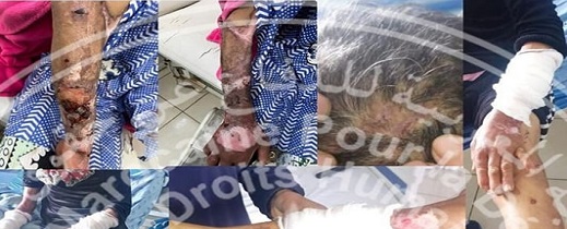 احتجاز وتعذيب عاملة منزلية داخل بيت مشغلها بالناظور احتجاز وتعذيب عاملة منزلية داخل بيت مشغلها بالناظور