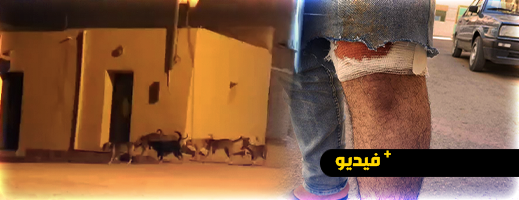 الكلاب الضالة تثير الرعب بحي بويزازان بالناظور.. 7 ضحايا ومطالب للجماعة بالتدخل