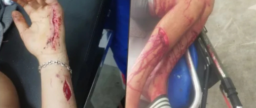 عصابة مسلحة تثير الرعب في الجديدة.. هجوم دموي على محل للفطائر وإصابة شاب بكسر في الجمجمة عصابة مسلحة تثير الرعب في الجديدة.. هجوم دموي على محل للفطائر وإصابة شاب بكسر في الجمجمة