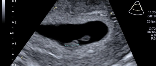 تخمينات الأطباء تقادمت.. الذكاء الاصطناعي يتنبأ بموعد ولادة الأطفال بدقة عالية تخمينات الأطباء تقادمت.. الذكاء الاصطناعي يتنبأ بموعد ولادة الأطفال بدقة عالية