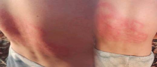 اعتداء وحشي على طفل يرعى الأغنام يهز الرأي العام المحلي اعتداء وحشي على طفل يرعى الأغنام يهز الرأي العام المحلي