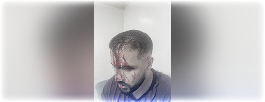 "اعتداء عنيف".. توقيف شخص اعتدى على طبيب بمستشفى 