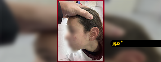 تعنيف تلميذة يجر أستاذة إلى شكاية رسمية بالناظور