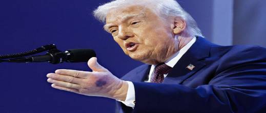 ترامب يشرح سبب الكدمة في يده اليسرى