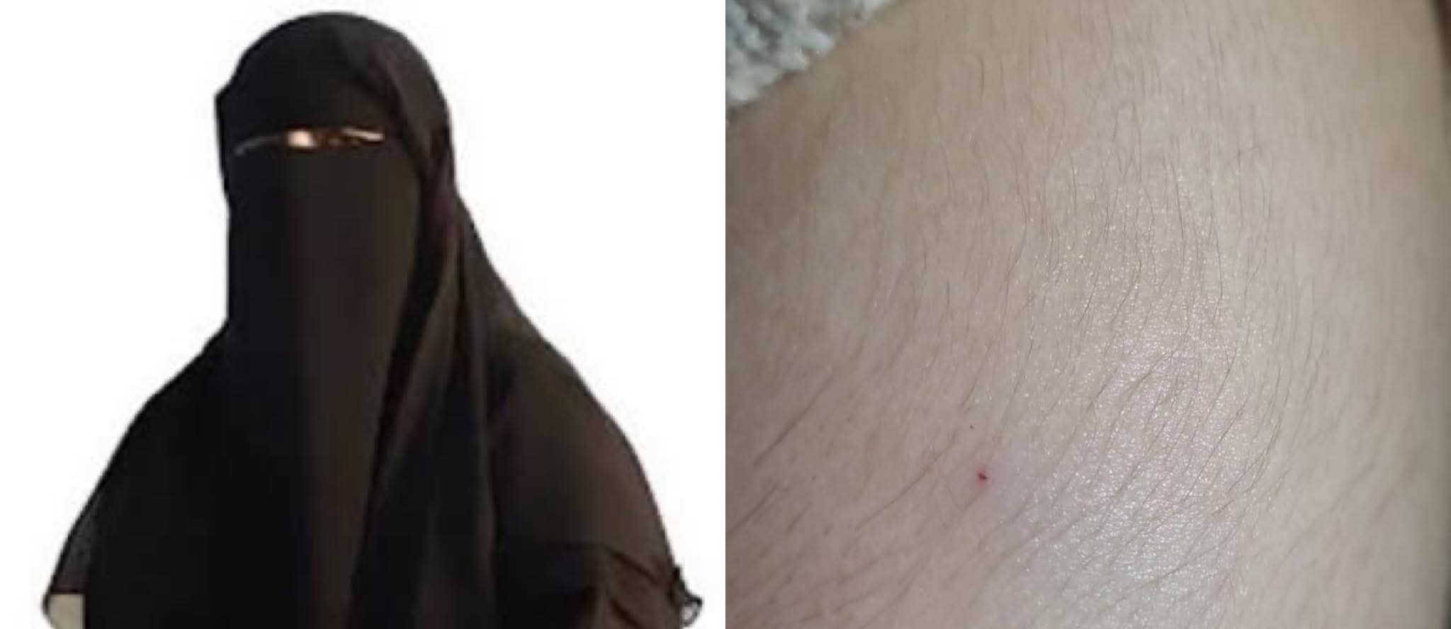 العروي.... اعتداء غامض بإبرة على تلميذة أثناء عودتها من المدرسة