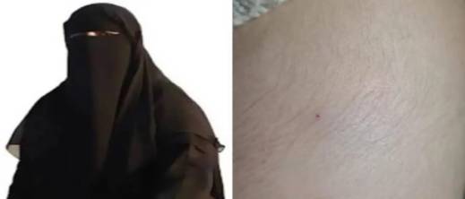 "لغز المنقبة" بالعروي ينتهي باعتراف صادم.. تلميذة تفجر مفاجأة وتكشف سبب اختلاقها لقصة "وخزة الإبرة"