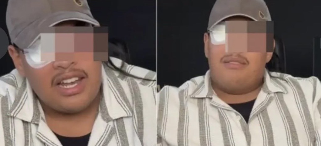 بسبب ضغط العمل.. صانع محتوى مغربي يكشف تفاصيل فقدانه البصر بإحدى عينيه