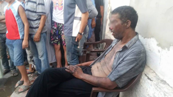 شخص يعاني من إضطرابات عقلية يشعل النار في جسده وسط مدينة بني طيب اقليم الدريوش