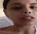 نجاح عملية زراعة الرئة للشابة "سلمى" بباريس بعد التكفل الملكي بحالتها