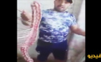 يحذر ساكنة  العروي من الظروف غير الصحية لبيع اللحوم