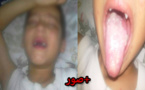 نسيم طفل من تمسمان يناشدكم مساعدته على العلاج من داء نادر ينهش جسده الصغير
