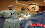 عملية جراحية بمستشفى محمد السادس بوجدة تكشف ولادة شاب برحم كامل 