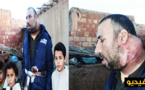 بالفيديو.. أب لثلاثة أطفال يعيش بورم كبير على مستوى العنق يطالب المحسنين مساعدته على العلاج