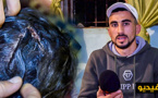 شاب ناظوري: عشيق جارتي المومس هوى على رأس زوجتي بسكين وأعاني من قلة ذات اليد